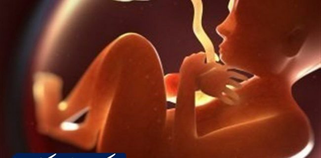 سقط جنین بالا در ایران